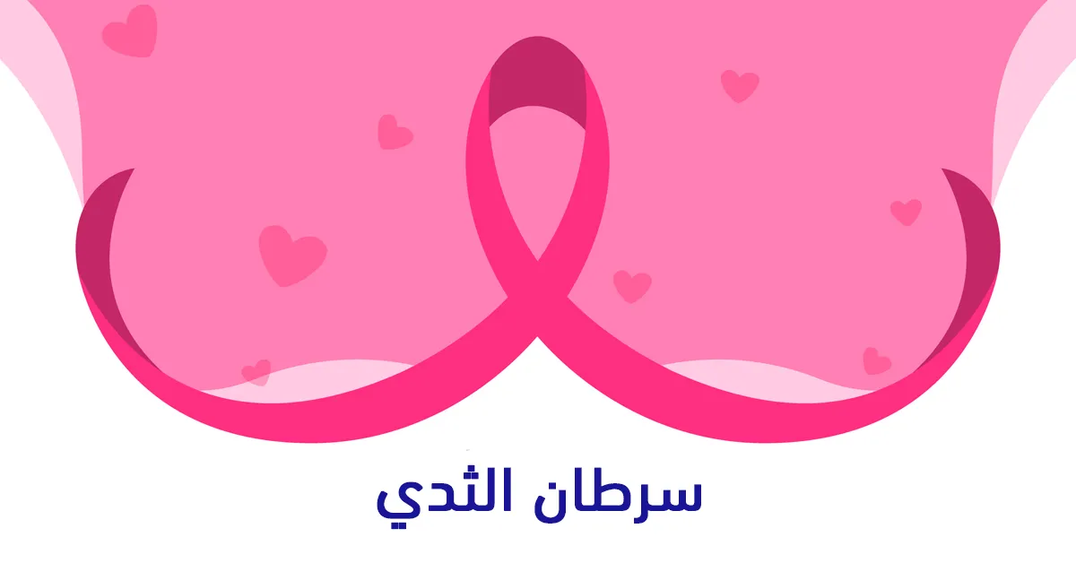 سرطان الثدي